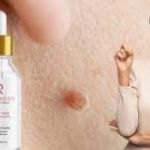 Amarose Skin Tag Remover Reviews- Does This Serum Help You to Smoothen Your Skin?