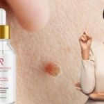 Amarose Skin Tag Remover Reviews Clean Skin Without Surgery!