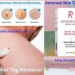 Paradise Skin Tag Remover Reviews 2023 Scam Exposed! Review the Truth Before Buy